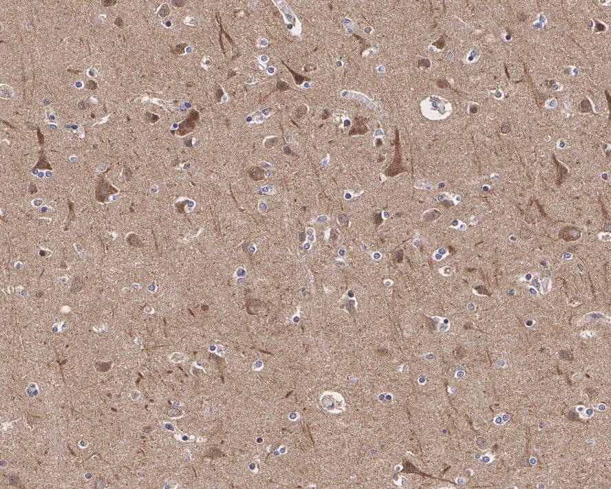 Immunohistochemistry: PRAS40 Antibody (JE30-60) [NBP3-32850] - Immunohistochemical analysis of paraffin-embedded human brain tissue with Rabbit anti-PRAS40 antibody (NBP3-32850) at 1/200 dilution. The section was pre-treated using heat mediated antigen retrieval with Tris-EDTA buffer (pH 9.0) for 20 minutes. The tissues were blocked in 1% BSA for 20 minutes at room temperature, washed with ddH2O and PBS, and then probed with the primary antibody (NBP3-32850) at 1/200 dilution for 1 hour at room temperature. The detection was performed using an HRP conjugated compact polymer system. DAB was used as the chromogen. Tissues were counterstained with hematoxylin and mounted with DPX.