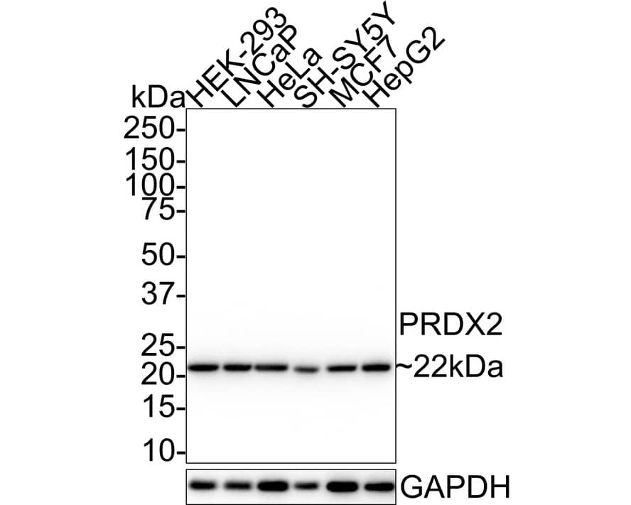 Western Blot: Peroxiredoxin 2 Antibody (7F5-R) [NBP3-32851] - Western blot analysis of Peroxiredoxin 2 on different lysates with Mouse anti-Peroxiredoxin 2 antibody (NBP3-32851) at 1/1,000 dilution. Lane 1: HEK-293 cell lysate Lane 2: LNCaP cell lysate Lane 3: HeLa cell lysate Lane 4: SH-SY5Y cell lysate Lane 5: MCF7 cell lysate Lane 6: HepG2 cell lysate Lysates/proteins at 20 ug/Lane. Predicted band size: 22 kDa Observed band size: 22 kDa Exposure time: 5 seconds; 4-20% SDS-PAGE gel. Proteins were transferred to a PVDF membrane and blocked with 5% NFDM/TBST for 1 hour at room temperature. The primary antibody (NBP3-32851) at 1/1,000 dilution was used in 5% NFDM/TBST at room temperature for 2 hours. Goat Anti-Mouse IgG - HRP Secondary Antibody at 1/50,000 dilution was used for 1 hour at room temperature.