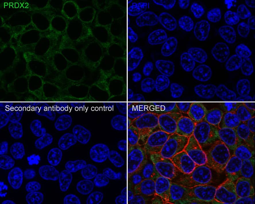 Immunocytochemistry/ Immunofluorescence: Peroxiredoxin 2 Antibody (7F5-R) [NBP3-32851] - Immunocytochemistry analysis of HeLa cells labeling Peroxiredoxin 2 with Mouse anti-Peroxiredoxin 2 antibody (NBP3-32851) at 1/100 dilution. Cells were fixed in 100% precooled methanol for 5 minutes at room temperature, then blocked with 1% BSA in 10% negative goat serum for 1 hour at room temperature. Cells were then incubated with Mouse anti-Peroxiredoxin 2 antibody (NBP3-32851) at 1/100 dilution in 1% BSA in PBST overnight at 4 ℃. Goat Anti-Mouse IgG H&L (iFluor™ 488) was used as the secondary antibody at 1/1,000 dilution. PBS instead of the primary antibody was used as the secondary antibody only control. Nuclear DNA was labelled in blue with DAPI. beta Tubulin (red) was stained at 1/100 dilution overnight at +4℃. Goat Anti-Rabbit IgG H&L (iFluor™ 594) were used as the secondary antibody at 1/1,000 dilution.