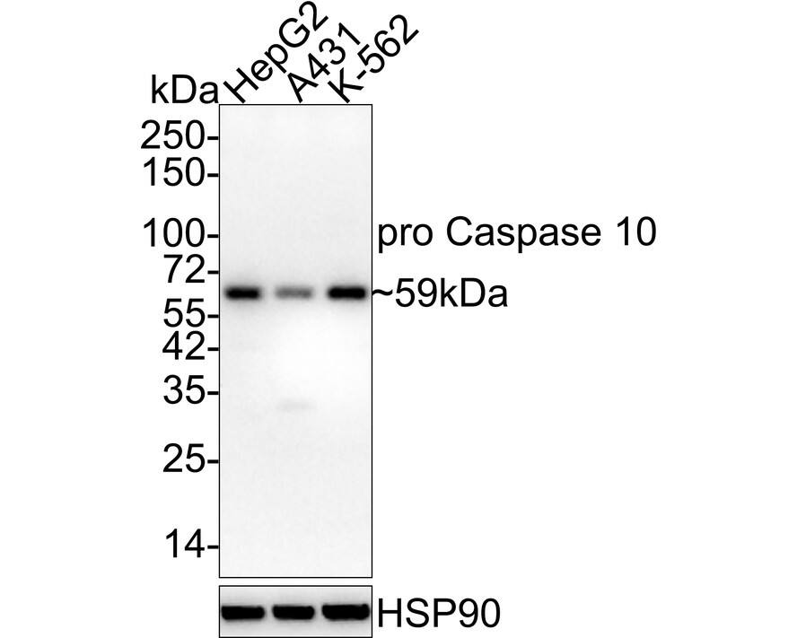 Western blot analysis on different lysates with NBP3-32856 at 1/1,000 dilution. Lane 1: HepG2 cell lysate Lane 2: A431 cell lysate Lane 3: K-562 cell lysate Lysates/proteins at 20 µg/Lane. Predicted band size: 59 kDa Observed band size: 59 kDa Exposure time: 3 minutes;  4-20% SDS-PAGE gel. Proteins were transferred to a PVDF membrane and blocked with 5% NFDM/TBST for 1 hour at room temperature. NBP3-32856 at 1/1,000 dilution was used in 5% NFDM/TBST at 4℃ overnight. Goat Anti-Rabbit IgG [HRP] Secondary Antibody at 1/50,000 dilution was used for 1 hour at room temperature.