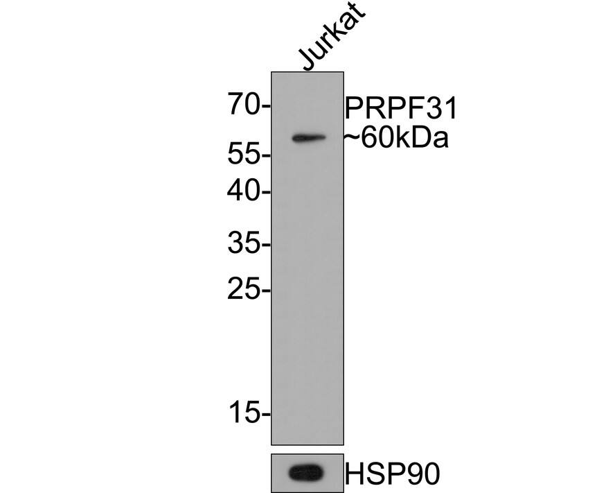 Western Blot PRPF31 Antibody (JE64-82)