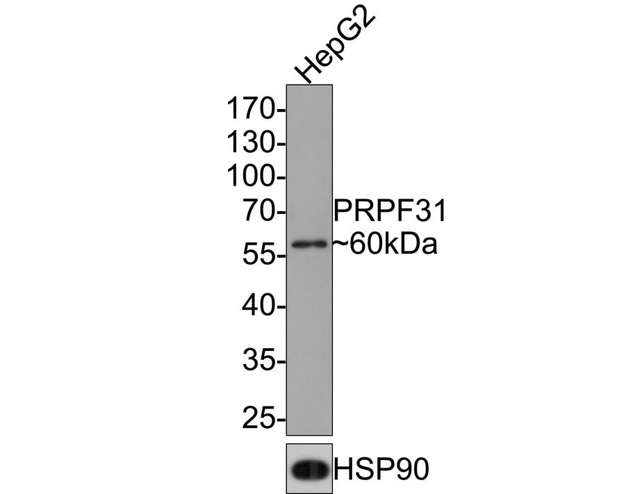 Western Blot PRPF31 Antibody (JE64-82)