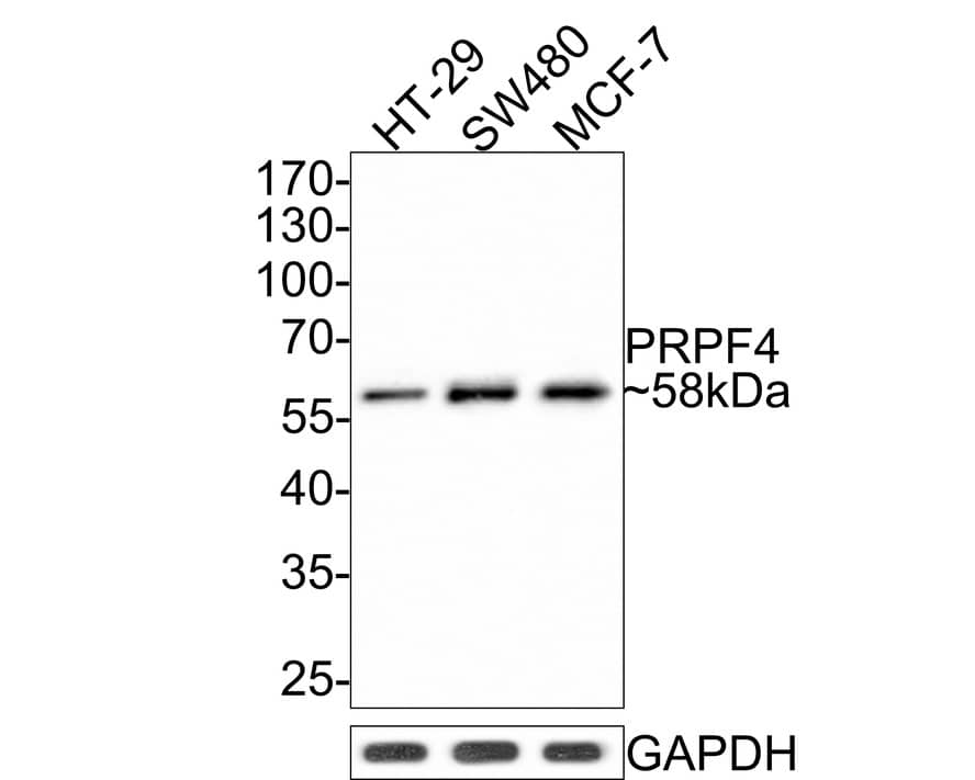 Western Blot: PRPF4 Antibody (JE65-37) [NBP3-32858] - Western blot analysis of PRPF4 on different lysates with Rabbit anti-PRPF4 antibody (NBP3-32858) at 1/500 dilution. Lane 1: HT-29 cell lysate Lane 2: SW480 cell lysate Lane 3: MCF-7 cell lysate Lysates/proteins at 10 ug/Lane. Predicted band size: 58 kDa Observed band size: 58 kDa Exposure time: 2 minutes; 10% SDS-PAGE gel. Proteins were transferred to a PVDF membrane and blocked with 5% NFDM/TBST for 1 hour at room temperature. The primary antibody (NBP3-32858) at 1/500 dilution was used in 5% NFDM/TBST at room temperature for 2 hours. Goat Anti-Rabbit IgG - HRP Secondary Antibody at 1:300,000 dilution was used for 1 hour at room temperature.