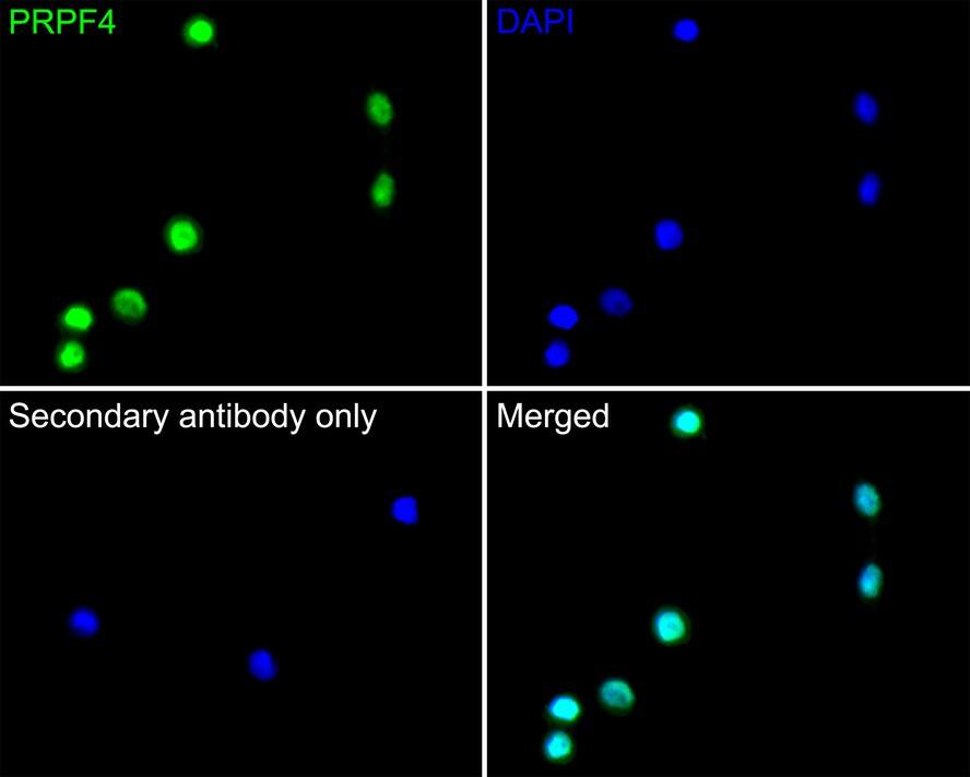 Immunocytochemistry/ Immunofluorescence: PRPF4 Antibody (JE65-37) [NBP3-32858] - Immunocytochemistry analysis of SiHa cells labeling PRPF4 with Rabbit anti-PRPF4 antibody (NBP3-32858) at 1/200 dilution. Cells were fixed in 4% paraformaldehyde for 10 minutes at 37 ℃, permeabilized with 0.05% Triton X-100 in PBS for 20 minutes, and then blocked with 2% negative goat serum for 30 minutes at room temperature. Cells were then incubated with Rabbit anti-PRPF4 antibody (NBP3-32858) at 1/200 dilution in 2% negative goat serum overnight at 4 ℃. Goat Anti-Rabbit IgG H&L (Alexa Fluor® 488) was used as the secondary antibody at 1/1,000 dilution. PBS instead of the primary antibody was used as the secondary antibody only control. Nuclear DNA was labelled in blue with DAPI.