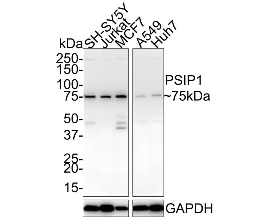 Western blot analysis on different lysates with NBP3-32859 at 1/1,000 dilution. Lane 1: SH-SY5Y cell lysate (30 µg/Lane) Lane 2: Jurkat cell lysate (30 µg/Lane) Lane 3: MCF7 cell lysate (30 µg/Lane) Lane 4: A549 cell lysate (30 µg/Lane) Lane 5: Huh7 cell lysate (30 µg/Lane) Predicted band size: 60 kDa Observed band size: 75 kDa Exposure time: 3 minutes;  4-20% SDS-PAGE gel. Proteins were transferred to a PVDF membrane and blocked with 5% NFDM/TBST for 1 hour at room temperature. NBP3-32859 at 1/1,000 dilution was used in 5% NFDM/TBST at 4℃ overnight. Goat Anti-Rabbit IgG [HRP] Secondary Antibody at 1/100,000 dilution was used for 1 hour at room temperature.
