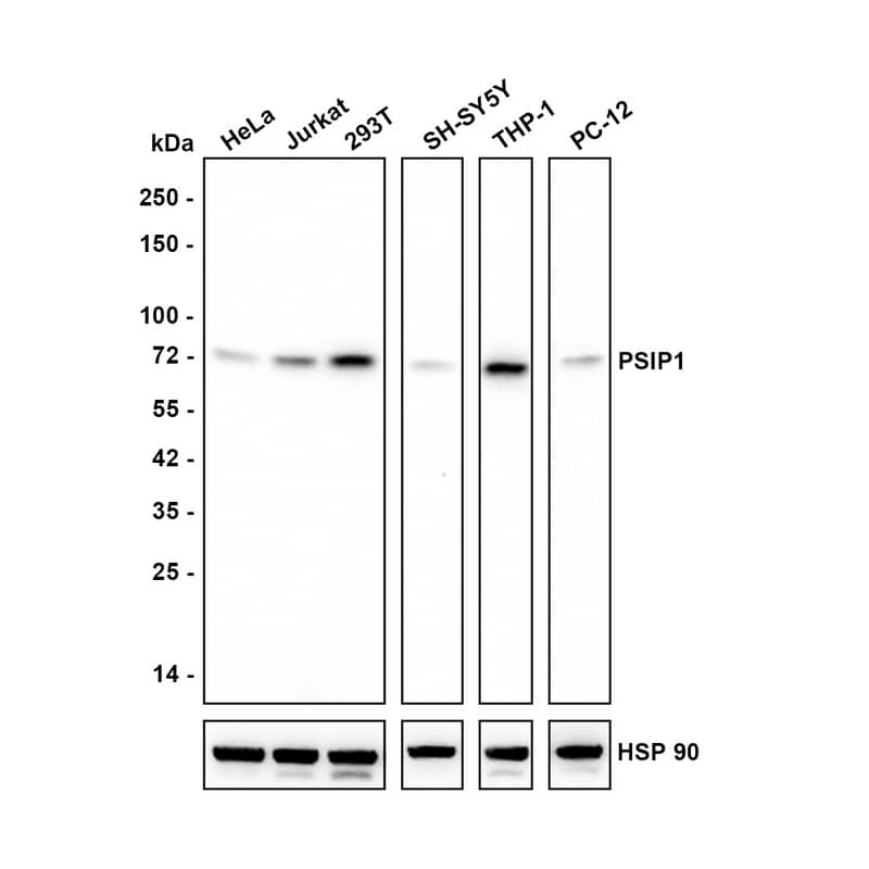 Western blot analysis on different lysates with NBP3-32860 at 1/1,000 dilution. Lane 1: HeLa cell lysate Lane 2: Jurkat cell lysate Lane 3: 293T cell lysate Lane 4: SH-SY5Y cell lysate Lane 5: THP-1 cell lysate Lane 6: PC-12 cell lysate Lysates/proteins at 20 µg/Lane. Predicted band size: 60 kDa Observed band size: 75 kDa Exposure time: 3 minutes; 4-20% SDS-PAGE gel. Proteins were transferred to a PVDF membrane and blocked with 5% NFDM/TBST for 1 hour at room temperature. NBP3-32860 at 1/1,000 dilution was used in 5% NFDM/TBST at 4℃ overnight. Goat Anti-Rabbit IgG [HRP] Secondary Antibody at 1/50,000 dilution was used for 1 hour at room temperature.