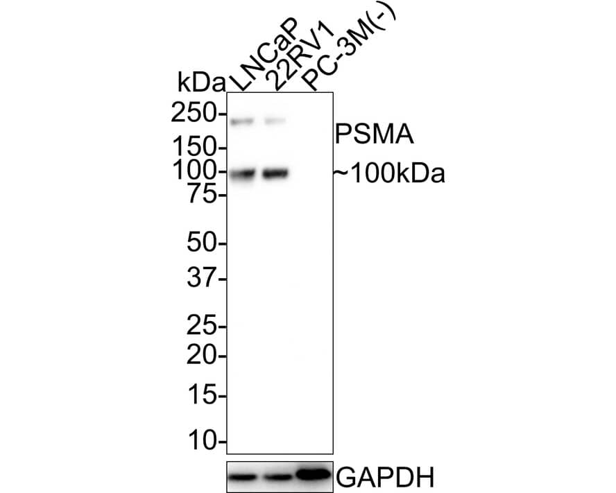 Western blot analysis on different lysates with NBP3-32861 at 1/1,000 dilution. Lane 1: LNCaP cell lysate Lane 2: 22RV1 cell lysate Lane 3: PC-3M cell lysate (negative) Lysates/proteins at 20 µg/Lane. Predicted band size: 84 kDa Observed band size: 100/200 kDa Exposure time: 1 minute 20 seconds; 4-20% SDS-PAGE gel. Proteins were transferred to a PVDF membrane and blocked with 5% NFDM/TBST for 1 hour at room temperature. NBP3-32861 at 1/1,000 dilution was used in 5% NFDM/TBST at room temperature for 2 hours. Goat Anti-Rabbit IgG [HRP] Secondary Antibody at 1:100,000 dilution was used for 1 hour at room temperature.