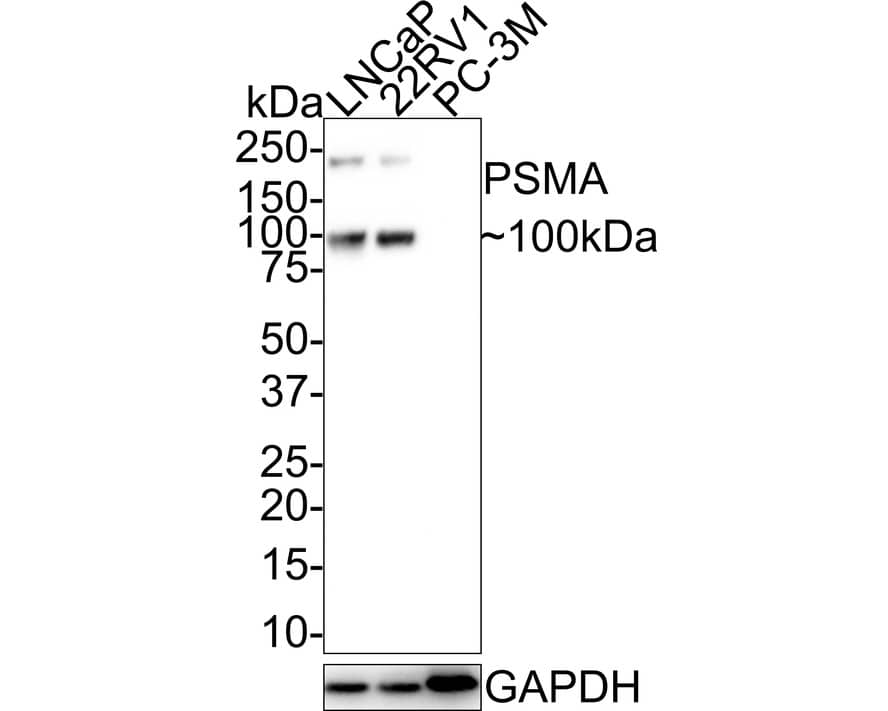 Western Blot: PSMA/FOLH1/NAALADase I Antibody (JE42-45) [NBP3-32861] - Western blot analysis of PSMA/FOLH1/NAALADase I on different lysates with Rabbit anti-PSMA/FOLH1/NAALADase I antibody (NBP3-32861) at 1/1,000 dilution. Lane 1: LNCaP cell lysate Lane 2: 22RV1 cell lysate Lane 3: PC-3M cell lysate (negative) Lysates/proteins at 20 ug/Lane. Predicted band size: 84 kDa Observed band size: 100/200 kDa Exposure time: 1 minute 20 seconds; 4-20% SDS-PAGE gel. Proteins were transferred to a PVDF membrane and blocked with 5% NFDM/TBST for 1 hour at room temperature. The primary antibody (NBP3-32861) at 1/1,000 dilution was used in 5% NFDM/TBST at room temperature for 2 hours. Goat Anti-Rabbit IgG - HRP Secondary Antibody at 1:100,000 dilution was used for 1 hour at room temperature.