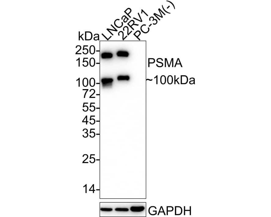 Western blot analysis on different lysates with NBP3-32862 at 1/1,000 dilution. Lane 1: LNCaP cell lysate Lane 2: 22RV1 cell lysate Lane 3: PC-3M cell lysate (negative) Lysates/proteins at 20 µg/Lane. Predicted band size: 84 kDa Observed band size: 100/200 kDa Exposure time: 15 seconds; 4-20% SDS-PAGE gel. Proteins were transferred to a PVDF membrane and blocked with 5% NFDM/TBST for 1 hour at room temperature. NBP3-32862 at 1/1,000 dilution was used in 5% NFDM/TBST at 4℃ overnight. Goat Anti-Rabbit IgG [HRP] Secondary Antibody at 1/50,000 dilution was used for 1 hour at room temperature.