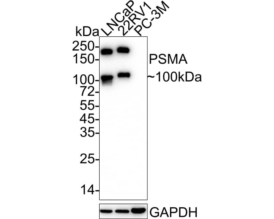 Western Blot: PSMA/FOLH1/NAALADase I Antibody (PD00-72) [NBP3-32862] - Western blot analysis of PSMA/FOLH1/NAALADase I on different lysates with Rabbit anti-PSMA/FOLH1/NAALADase I antibody (NBP3-32862) at 1/1,000 dilution. Lane 1: LNCaP cell lysate Lane 2: 22RV1 cell lysate Lane 3: PC-3M cell lysate (negative) Lysates/proteins at 20 ug/Lane. Predicted band size: 84 kDa Observed band size: 100/200 kDa Exposure time: 15 seconds; 4-20% SDS-PAGE gel. Proteins were transferred to a PVDF membrane and blocked with 5% NFDM/TBST for 1 hour at room temperature. The primary antibody (NBP3-32862) at 1/1,000 dilution was used in 5% NFDM/TBST at 4C overnight. Goat Anti-Rabbit IgG - HRP Secondary Antibody at 1/50,000 dilution was used for 1 hour at room temperature.