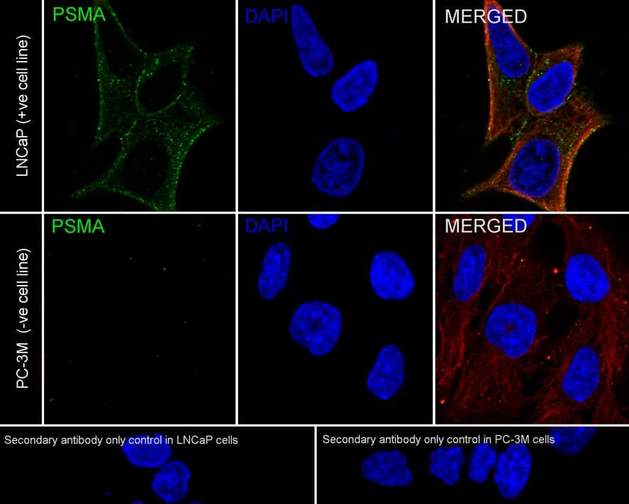 Immunocytochemistry/ Immunofluorescence: PSMA/FOLH1/NAALADase I Antibody (PD00-72) [NBP3-32862] - Immunocytochemistry analysis of LNCaP (positive) and PC-3M (negative) cells labeling PSMA/FOLH1/NAALADase I with Rabbit anti-PSMA/FOLH1/NAALADase I/FOLH1/NAALADase I antibody (NBP3-32862) at 1/100 dilution. Cells were fixed in 100% precooled methanol for 5 minutes at room temperature, then blocked with 1% BSA in 10% negative goat serum for 1 hour at room temperature. Cells were then incubated with Rabbit anti-PSMA/FOLH1/NAALADase I antibody (NBP3-32862) at 1/100 dilution in 1% BSA in PBST overnight at 4 ℃. Goat Anti-Rabbit IgG H&L (iFluor™ 488) was used as the secondary antibody at 1/1,000 dilution. PBS instead of the primary antibody was used as the secondary antibody only control. Nuclear DNA was labelled in blue with DAPI. Beta tubulin (red) was stained at 1/100 dilution overnight at +4℃. Goat Anti-Mouse IgG H&L (iFluor™ 594) was used as the secondary antibody at 1/1,000 dilution.