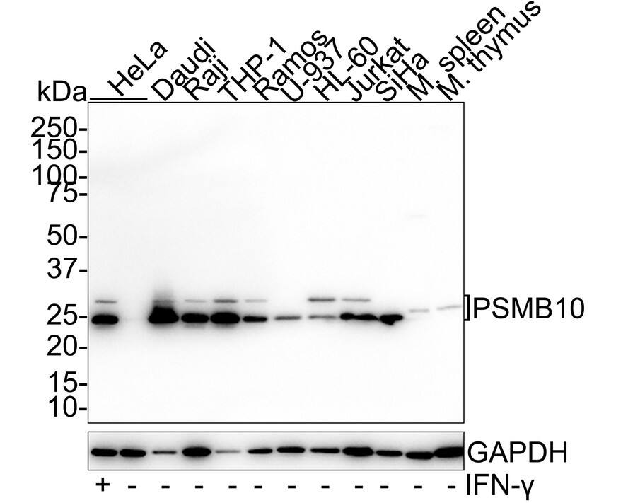 Western Blot: PSMB10/MECL1 Antibody (PSH01-58) [NBP3-32863] - Western blot analysis of PSMB10/MECL1 on different lysates with Rabbit anti-PSMB10/MECL1 antibody (NBP3-32863) at 1/1,000 dilution. Lane 1: HeLa treated with 100ng/mL IFN-  for 48 hours cell lysate (20 ug/Lane) Lane 2: HeLa cell lysate (20 ug/Lane) Lane 3: Daudi cell lysate (20 ug/Lane) Lane 4: Raji cell lysate (20 ug/Lane) Lane 5: THP-1 cell lysate (20 ug/Lane) Lane 6: Ramos cell lysate (20 ug/Lane) Lane 7: U-937 cell lysate (20 ug/Lane) Lane 8: HL-60 cell lysate (20 ug/Lane) Lane 9: Jurkat cell lysate (20 ug/Lane) Lane 10: SiHa cell lysate (20 ug/Lane) Lane 11: Mouse spleen tissue lysate (40 ug/Lane) Lane 12: Mouse thymus tissue lysate (40 ug/Lane) Predicted band size: 29 kDa Observed band size: 25/29 kDa Exposure time: 43 seconds; 4-20% SDS-PAGE gel. Proteins were transferred to a PVDF membrane and blocked with 5% NFDM/TBST for 1 hour at room temperature. The primary antibody (NBP3-32863) at 1/1,000 dilution was used in 5% NFDM/TBST at room temperature for 2 hours. Goat Anti-Rabbit IgG - HRP Secondary Antibody at 1/50,000 dilution was used for 1 hour at room temperature.