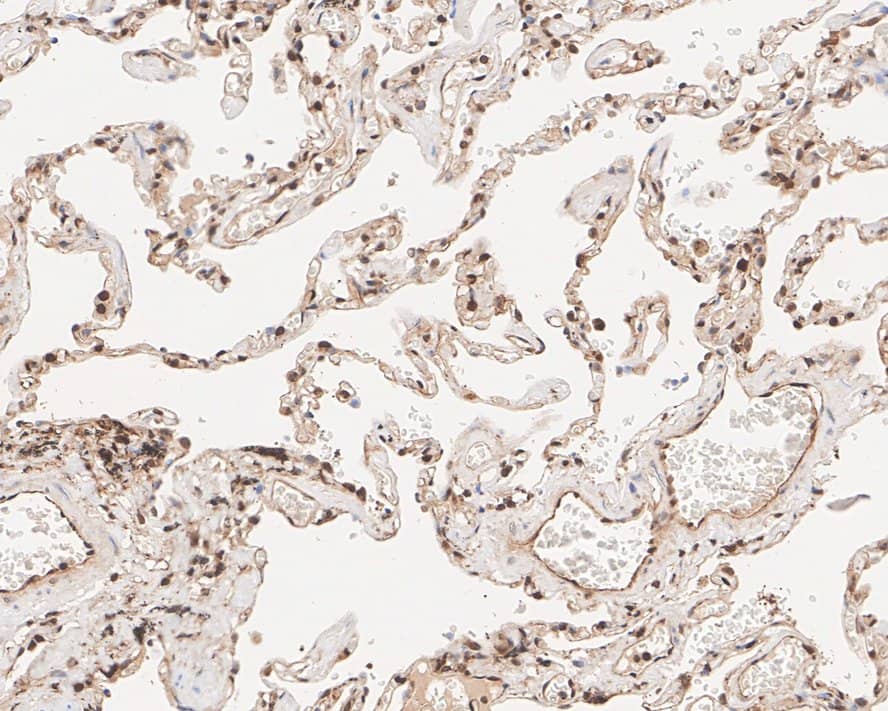 Immunohistochemistry: PSMB10/MECL1 Antibody (PSH01-58) [NBP3-32863] - Immunohistochemical analysis of paraffin-embedded human lung tissue with Rabbit anti-PSMB10/MECL1 antibody (NBP3-32863) at 1/1,000 dilution. The section was pre-treated using heat mediated antigen retrieval with Tris-EDTA buffer (pH 9.0) for 20 minutes. The tissues were blocked in 1% BSA for 20 minutes at room temperature, washed with ddH2O and PBS, and then probed with the primary antibody (NBP3-32863) at 1/1,000 dilution for 1 hour at room temperature. The detection was performed using an HRP conjugated compact polymer system. DAB was used as the chromogen. Tissues were counterstained with hematoxylin and mounted with DPX.