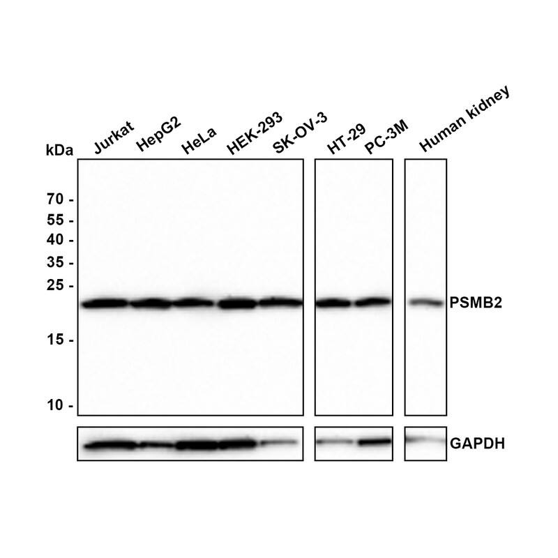 Western blot analysis on different lysates with NBP3-32864 at 1/1,000 dilution. Lane 1: Jurkat cell lysate Lane 2: HepG2 cell lysate Lane 3: HeLa cell lysate Lane 4: HEK-293 cell lysate Lane 5: SK-OV-3 cell lysate Lane 6: HT-29 cell lysate Lane 7: PC-3M cell lysate Lane 8: Human kidney tissue lysate Lysates/proteins at 40 µg/Lane. Predicted band size: 23 kDa Observed band size: 23 kDa Exposure time: 2 minutes; 15% SDS-PAGE gel. Proteins were transferred to a PVDF membrane and blocked with 5% NFDM for 1 hour at room temperature. NBP3-32864 at 1/1,000 dilution was used in 5% NFDM at room temperature for 2 hours. Goat Anti-Rabbit IgG [HRP] Secondary Antibody at 1:300,000 dilution was used for 1 hour at room temperature.