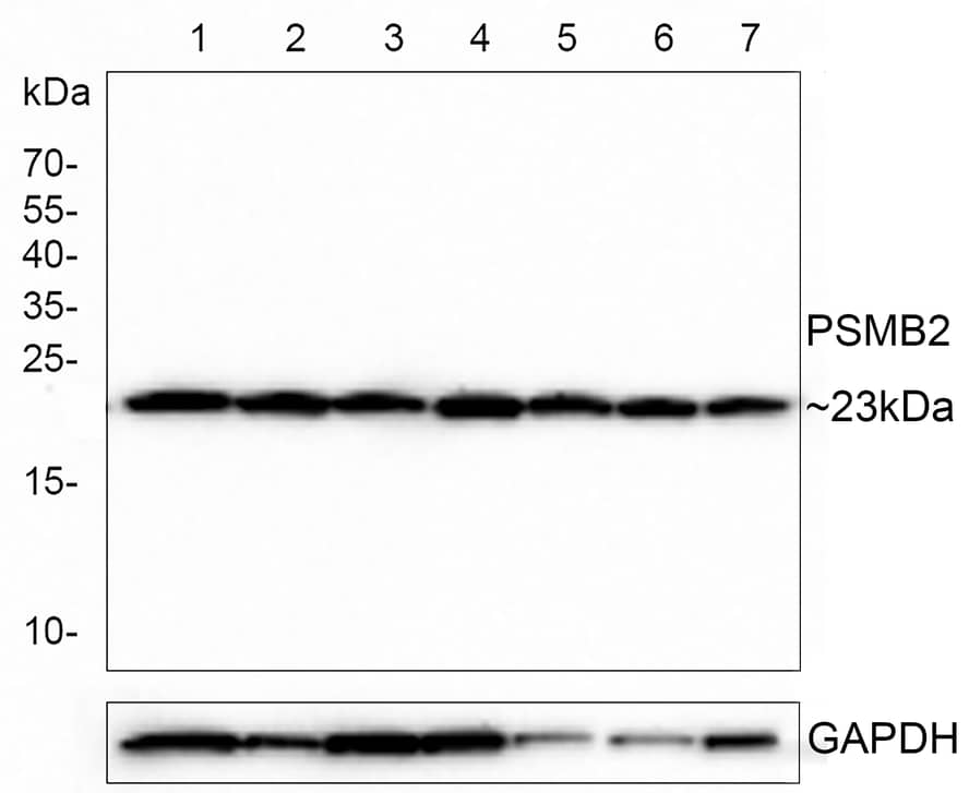 Western Blot: Proteasome 20S beta2 Antibody (PSH0-28) [NBP3-32864] - Western blot analysis of Proteasome 20S beta2 on different lysates with Rabbit anti-Proteasome 20S beta2 antibody (NBP3-32864) at 1/1,000 dilution. Lane 1: Jurkat cell lysate  Lane 2: HepG2 cell lysate  Lane 3: HeLa cell lysate Lane 4: HEK-293 cell lysate Lane 5: SK-OV-3 cell lysate Lane 6: HT-29 cell lysate Lane 7: PC-3M cell lysate Lysates/proteins at 10 ug/Lane. Predicted band size: 23 kDa Observed band size: 23 kDa Exposure time: 2 minutes; 15% SDS-PAGE gel. Proteins were transferred to a PVDF membrane and blocked with 5% NFDM for 1 hour at room temperature. The primary antibody (NBP3-32864) at 1/1,000 dilution was used in 5% NFDM at room temperature for 2 hours. Goat Anti-Rabbit IgG - HRP Secondary Antibody at 1:300,000 dilution was used for 1 hour at room temperature.