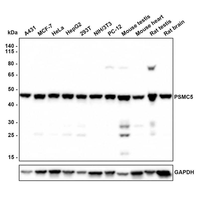 Western blot analysis on different lysates with NBP3-32865 at 1/1,000 dilution. Lane 1: A431 cell lysate (20 µg/Lane) Lane 2: MCF-7 cell lysate (20 µg/Lane) Lane 3: Hela cell lysate (20 µg/Lane) Lane 4: HepG2 cell lysate (20 µg/Lane) Lane 5: 293T cell lysate (20 µg/Lane) Lane 6: NIH/3T3 cell lysate (20 µg/Lane) Lane 7: PC-12 cell lysate (20 µg/Lane) Lane 8: Mouse testis tissue lysate (40 µg/Lane) Lane 9: Mouse heart tissue lysate (40 µg/Lane) Lane 10: Rat testis tissue lysate (40 µg/Lane) Lane 11: Rat brain tissue lysate (40 µg/Lane) Predicted band size: 46 kDa Observed band size: 46 kDa Exposure time: 30 seconds; 4-20% SDS-PAGE gel. Proteins were transferred to a PVDF membrane and blocked with 5% NFDM/TBST for 1 hour at room temperature. NBP3-32865 at 1/1,000 dilution was used in 5% NFDM/TBST at room temperature for 2 hours. Goat Anti-Rabbit IgG [HRP] Secondary Antibody at 1:300,000 dilution was used for 1 hour at room temperature.