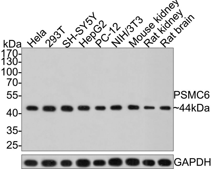 Western Blot: PSMC6 Antibody (PSH0-12) [NBP3-32866] - Western blot analysis of PSMC6 on different lysates with Rabbit anti-PSMC6 antibody (NBP3-32866) at 1/1,000 dilution. Lane 1: Hela cell lysate (10 ug/Lane) Lane 2: 293T cell lysate (10 ug/Lane) Lane 3: SH-SY5Y cell lysate (10 ug/Lane) Lane 4: HepG2 cell lysate (10 ug/Lane) Lane 5: PC-12 cell lysate (10 ug/Lane) Lane 6: NIH/3T3 cell lysate (10 ug/Lane) Lane 7: Mouse kidney tissue lysate (20 ug/Lane) Lane 8: Rat kidney tissue lysate (20 ug/Lane) Lane 9: Rat brain tissue lysate (20 ug/Lane) Predicted band size: 44 kDa Observed band size: 44 kDa Exposure time: 2 minutes; 10% SDS-PAGE gel. Proteins were transferred to a PVDF membrane and blocked with 5% NFDM/TBST for 1 hour at room temperature. The primary antibody (NBP3-32866) at 1/1,000 dilution was used in 5% NFDM/TBST at room temperature for 2 hours. Goat Anti-Rabbit IgG - HRP Secondary Antibody at 1:300,000 dilution was used for 1 hour at room temperature.