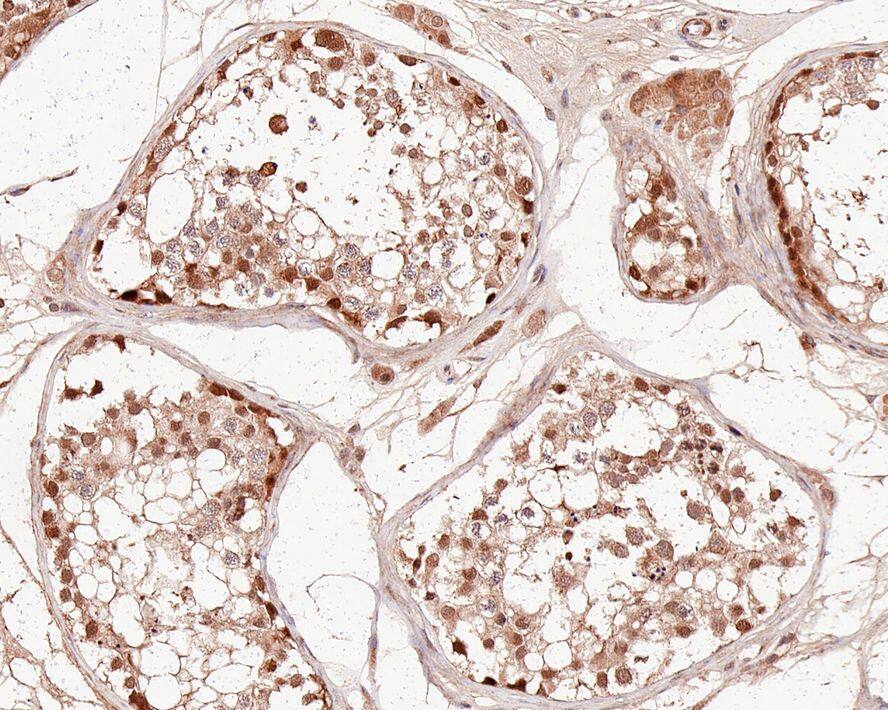 Immunohistochemistry: PSMC6 Antibody (PSH0-12) [NBP3-32866] - Immunohistochemical analysis of paraffin-embedded human testis tissue with Rabbit anti-PSMC6 antibody (NBP3-32866) at 1/400 dilution. The section was pre-treated using heat mediated antigen retrieval with sodium citrate buffer (pH 6.0) for 2 minutes. The tissues were blocked in 1% BSA for 20 minutes at room temperature, washed with ddH2O and PBS, and then probed with the primary antibody (NBP3-32866) at 1/400 dilution for 1 hour at room temperature. The detection was performed using an HRP conjugated compact polymer system. DAB was used as the chromogen. Tissues were counterstained with hematoxylin and mounted with DPX.