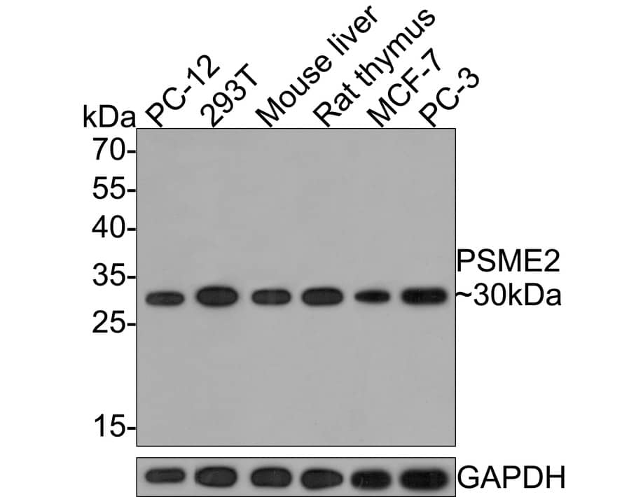 Western Blot PA28 Activator beta Subunit/PSME2 Antibody (PSH0-10)