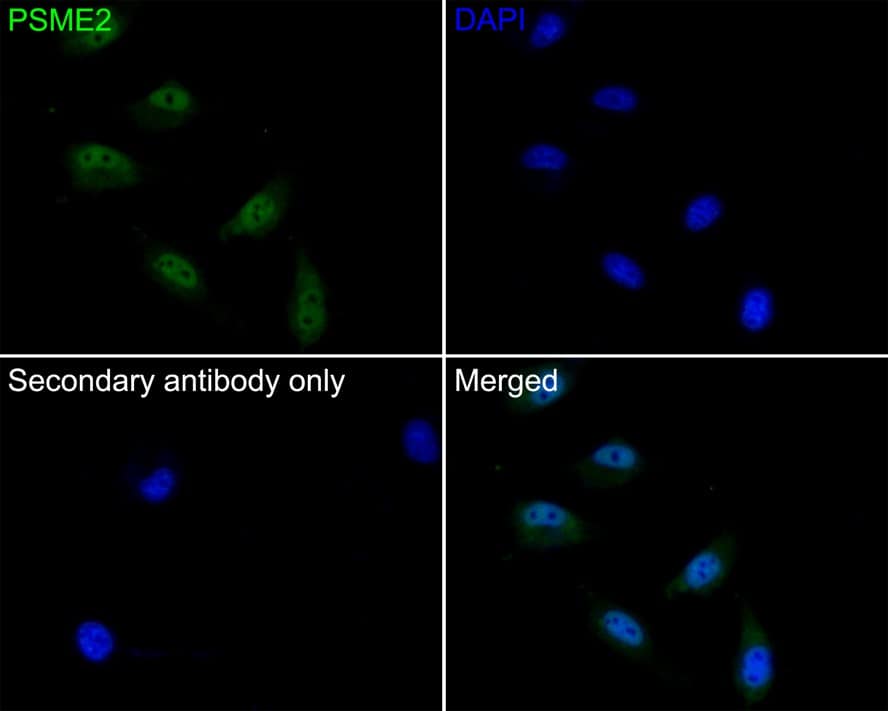 Immunocytochemistry/ Immunofluorescence PA28 Activator beta Subunit/PSME2 Antibody (PSH0-10)