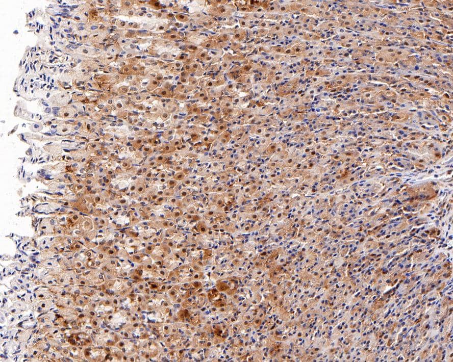 Immunohistochemistry PA28 Activator beta Subunit/PSME2 Antibody (PSH0-10)