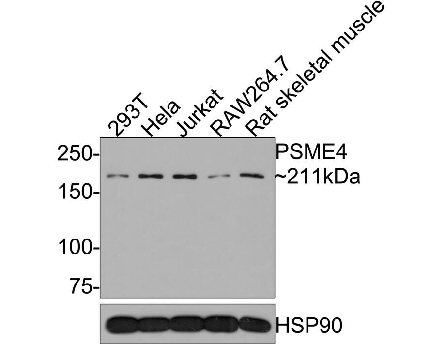 Western Blot: PSME4 Antibody [NBP3-32869] - Western blot analysis of PSME4 on different lysates with Rabbit anti-PSME4 antibody (NBP3-32869) at 1/500 dilution. Lane 1: 293T cell lysate (10 ug/Lane) Lane 2: Hela cell lysate (10 ug/Lane) Lane 3: Jurkat cell lysate (10 ug/Lane) Lane 4: RAW264.7 cell lysate (10 ug/Lane) Lane 5: Rat skeletal muscle tissue lysate (20 ug/Lane) Predicted band size: 211 kDa Observed band size: 211 kDa Exposure time: 2 minutes; 6% SDS-PAGE gel. Proteins were transferred to a PVDF membrane and blocked with 5% NFDM/TBST for 1 hour at room temperature. The primary antibody (NBP3-32869) at 1/500 dilution was used in 5% NFDM/TBST at room temperature for 2 hours. Goat Anti-Rabbit IgG - HRP Secondary Antibody at 1:300,000 dilution was used for 1 hour at room temperature.