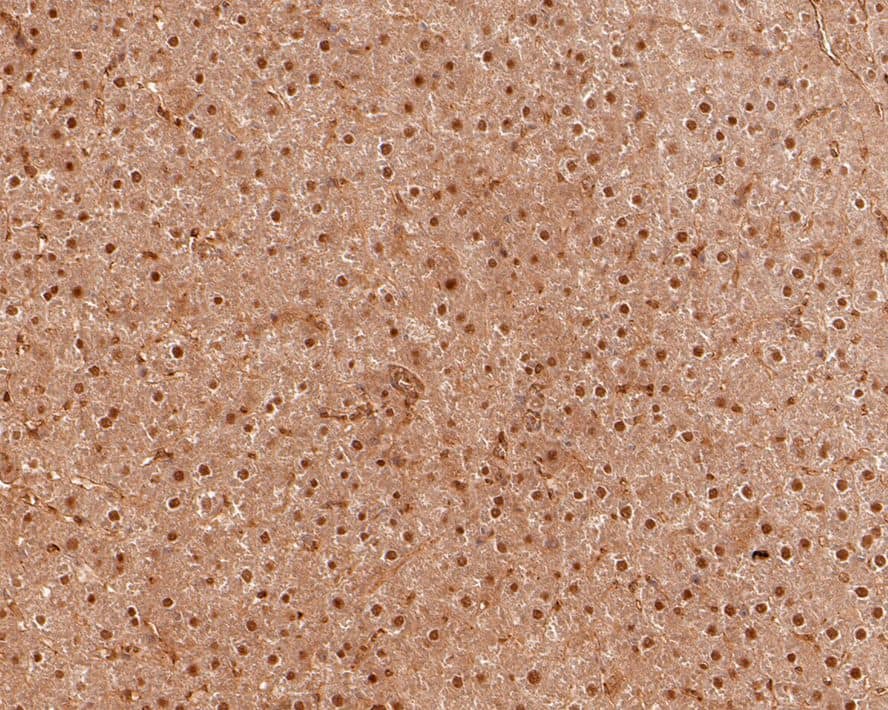 Immunohistochemistry: PSME4 Antibody [NBP3-32869] - Immunohistochemical analysis of paraffin-embedded rat liver tissue with Rabbit anti-PSME4 antibody (NBP3-32869) at 1/1,000 dilution. The section was pre-treated using heat mediated antigen retrieval with sodium citrate buffer (pH 6.0) for 2 minutes. The tissues were blocked in 1% BSA for 20 minutes at room temperature, washed with ddH2O and PBS, and then probed with the primary antibody (NBP3-32869) at 1/1,000 dilution for 1 hour at room temperature. The detection was performed using an HRP conjugated compact polymer system. DAB was used as the chromogen. Tissues were counterstained with hematoxylin and mounted with DPX.