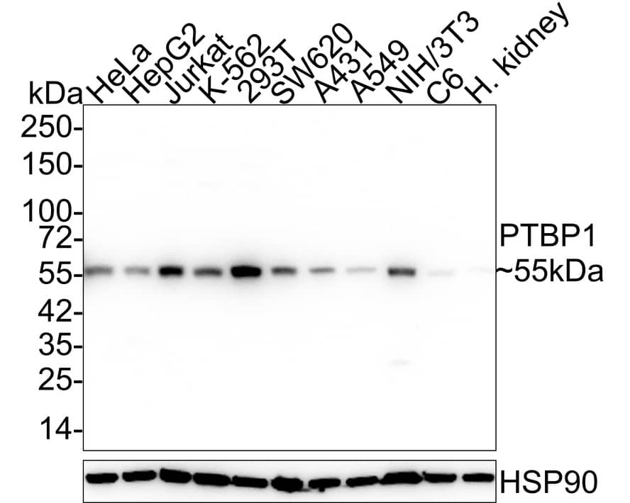 Western blot analysis on different lysates with NBP3-32870 at 1/1,000 dilution. Lane 1: HeLa cell lysate (20 µg/Lane) Lane 2: HepG2 cell lysate (20 µg/Lane) Lane 3: Jurkat cell lysate (20 µg/Lane) Lane 4: K-562 cell lysate (20 µg/Lane) Lane 5: 293T cell lysate (20 µg/Lane) Lane 6: SW620 cell lysate (20 µg/Lane) Lane 7: A431 cell lysate (20 µg/Lane) Lane 8: A549 cell lysate (20 µg/Lane) Lane 9: NIH/3T3 cell lysate (20 µg/Lane) Lane 10: C6 cell lysate (20 µg/Lane) Lane 11: Human kidney tissue lysate (40 µg/Lane) Predicted band size: 60 kDa Observed band size: 55 kDa Exposure time: 20 seconds; 4-20% SDS-PAGE gel. Proteins were transferred to a PVDF membrane and blocked with 5% NFDM/TBST for 1 hour at room temperature. NBP3-32870 at 1/1,000 dilution was used in 5% NFDM/TBST at 4℃ overnight. Goat anti-Mouse IgG [HRP] at 1/50,000 dilution was used for 1 hour at room temperature.