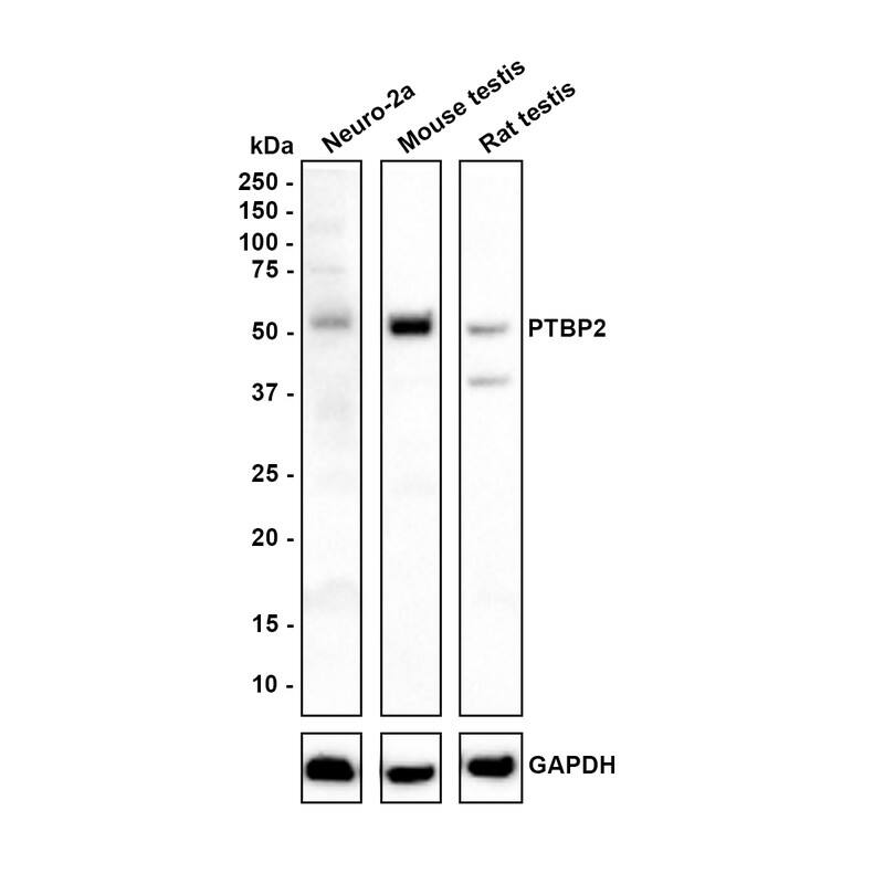Western blot analysis on different lysates with NBP3-32871 at 1/1,000 dilution. Lane 1: Neuro-2a cell lysate (15 µg/Lane) Lane 2: Mouse testis tissue lysate (30 µg/Lane) Lane 3: Rat testis tissue lysate (30 µg/Lane) Lysates/proteins at 10 µg/Lane. Predicted band size: 57 kDa Observed band size: 57 kDa Exposure time: 3 minutes; 4-20% SDS-PAGE gel. Proteins were transferred to a PVDF membrane and blocked with 5% NFDM/TBST for 1 hour at room temperature. NBP3-32871 at 1/1,000 dilution was used in 5% NFDM/TBST at room temperature for 2 hours. Goat Anti-Rabbit IgG [HRP] Secondary Antibody at 1:100,000 dilution was used for 1 hour at room temperature.