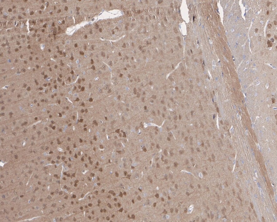 Immunohistochemistry: PTEN Antibody (JE51-96) [NBP3-32873] - Immunohistochemical analysis of paraffin-embedded mouse brain tissue with Rabbit anti-PTEN antibody (NBP3-32873) at 1/500 dilution. The section was pre-treated using heat mediated antigen retrieval with sodium citrate buffer (pH 6.0) for 2 minutes. The tissues were blocked in 1% BSA for 20 minutes at room temperature, washed with ddH2O and PBS, and then probed with the primary antibody (NBP3-32873) at 1/500 dilution for 1 hour at room temperature. The detection was performed using an HRP conjugated compact polymer system. DAB was used as the chromogen. Tissues were counterstained with hematoxylin and mounted with DPX.