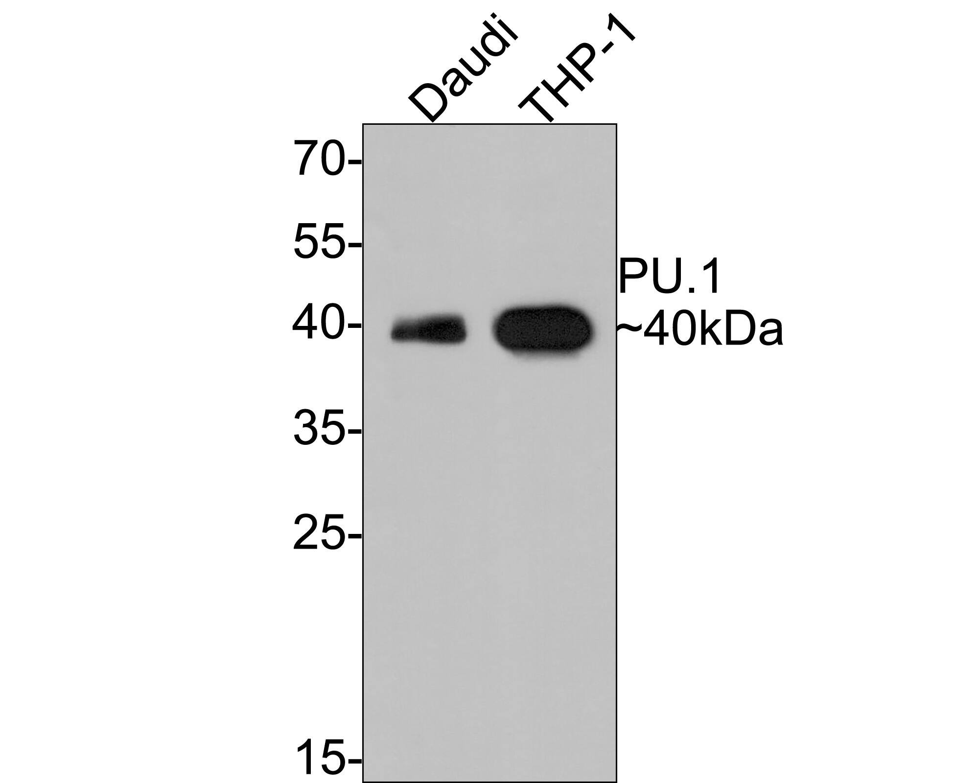Western blot analysis on different lysates with NBP3-32878 at 1/1,000 dilution. Lane 1: Daudi cell lysate Lane 2: THP-1 cell lysate Lysates/proteins at 10 µg/Lane. Predicted band size: 31 kDa Observed band size: 40 kDa Exposure time: 2 minutes; 12% SDS-PAGE gel. Proteins were transferred to a PVDF membrane and blocked with 5% NFDM/TBST for 1 hour at room temperature. NBP3-32878 at 1/1,000 dilution was used in 5% NFDM/TBST at room temperature for 2 hours. Goat Anti-Rabbit IgG [HRP] Secondary Antibody at 1:300,000 dilution was used for 1 hour at room temperature.