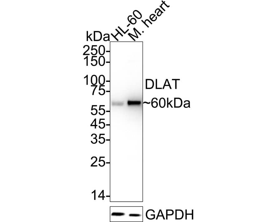 Western Blot Pyruvate Dehydrogenase E2 Antibody (JE34-38)