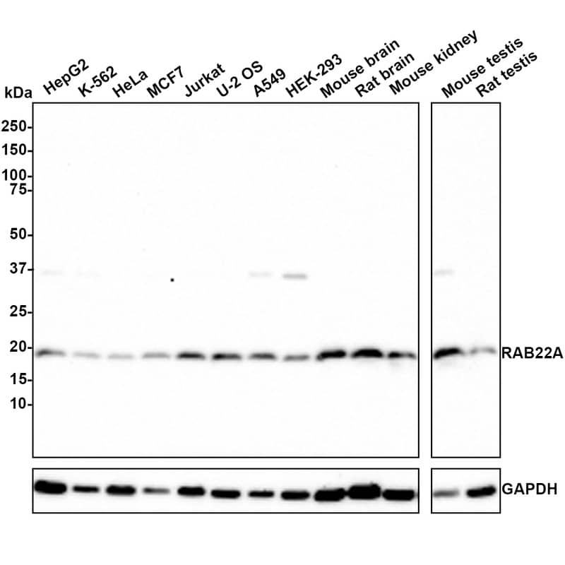 Western Blot RAB22A Antibody (JE66-08)