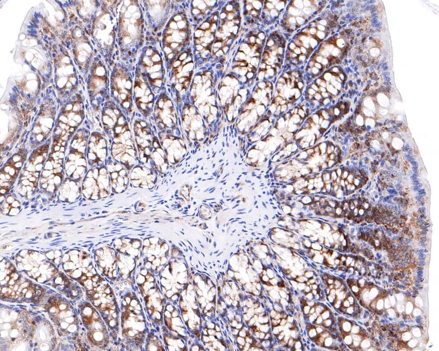 Immunohistochemistry RASEF Antibody (JE65-33)