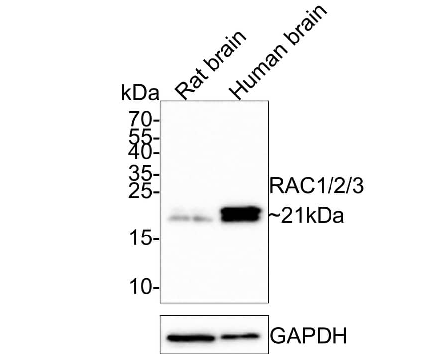 Western blot analysis on different lysates with NBP3-32887 at 1/500 dilution. Lane 1: Rat brain tissue lysate Lane 2: Human brain tissue lysate Lysates/proteins at 20 µg/Lane. Predicted band size: 21 kDa Observed band size: 21 kDa Exposure time: 5 minutes; 15% SDS-PAGE gel. Proteins were transferred to a PVDF membrane and blocked with 5% NFDM/TBST for 1 hour at room temperature. NBP3-32887 at 1/500 dilution was used in 5% NFDM/TBST at room temperature for 2 hours. Goat Anti-Rabbit IgG [HRP] Secondary Antibody at 1:300,000 dilution was used for 1 hour at room temperature.