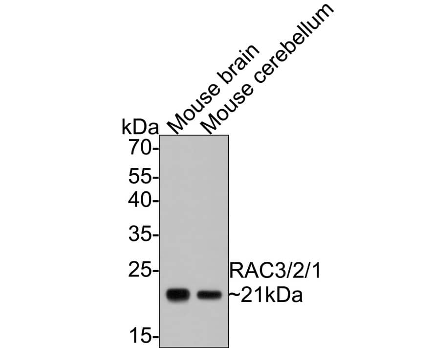 Western blot analysis on different lysates with NBP3-32887 at 1/500 dilution. Lane 1: Mouse brain tissue lysate Lane 2: Mouse cerebellum tissue lysate Lysates/proteins at 20 µg/Lane. Predicted band size: 21 kDa Observed band size: 21 kDa Exposure time: 1 minute; 12% SDS-PAGE gel. Proteins were transferred to a PVDF membrane and blocked with 5% NFDM/TBST for 1 hour at room temperature. NBP3-32887 at 1/500 dilution was used in 5% NFDM/TBST at room temperature for 2 hours. Goat Anti-Rabbit IgG [HRP] Secondary Antibody at 1:300,000 dilution was used for 1 hour at room temperature.