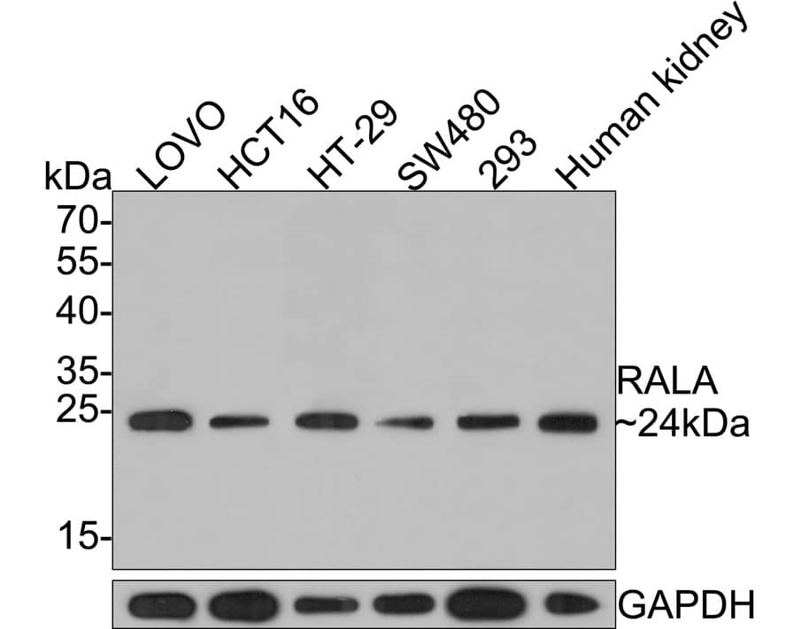 Western Blot: RalA Antibody (JE54-12) [NBP3-32891] - Western blot analysis of RalA on different lysates with Rabbit anti-RalA antibody (NBP3-32891) at 1/500 dilution. Lane 1: LOVO cell lysate (10 ug/Lane) Lane 2: HCT116 cell lysate (10 ug/Lane) Lane 3: HT-29 cell lysate (10 ug/Lane) Lane 4: SW480 cell lysate (10 ug/Lane) Lane 5: 293 cell lysate (10 ug/Lane) Lane 6: Human kidney tissue lysate (20 ug/Lane) Predicted band size: 24 kDa Observed band size: 24 kDa Exposure time: 2 minutes; 12% SDS-PAGE gel. Proteins were transferred to a PVDF membrane and blocked with 5% NFDM/TBST for 1 hour at room temperature. The primary antibody (NBP3-32891) at 1/500 dilution was used in 5% NFDM/TBST at room temperature for 2 hours. Goat Anti-Rabbit IgG - HRP Secondary Antibody at 1:300,000 dilution was used for 1 hour at room temperature.