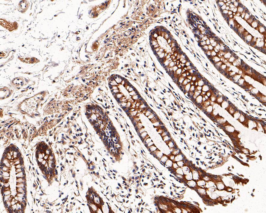 Immunohistochemistry: RalA Antibody (JE54-12) [NBP3-32891] - Immunohistochemical analysis of paraffin-embedded human colon tissue with Rabbit anti-RalA antibody (NBP3-32891) at 1/1,000 dilution. The section was pre-treated using heat mediated antigen retrieval with Tris-EDTA buffer (pH 9.0) for 20 minutes. The tissues were blocked in 1% BSA for 20 minutes at room temperature, washed with ddH2O and PBS, and then probed with the primary antibody (NBP3-32891) at 1/1,000 dilution for 1 hour at room temperature. The detection was performed using an HRP conjugated compact polymer system. DAB was used as the chromogen. Tissues were counterstained with hematoxylin and mounted with DPX.