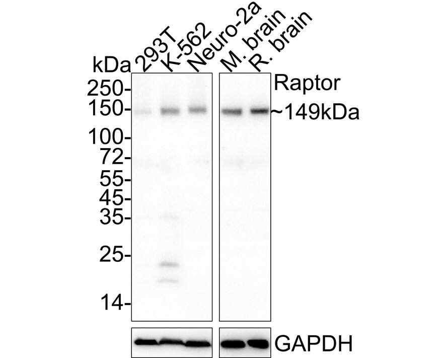 Western blot analysis on different lysates with NBP3-32894 at 1/2,000 dilution. Lane 1: 293T cell lysate (30 µg/Lane) Lane 2: K-562 cell lysate (30 µg/Lane) Lane 3: Neuro-2a cell lysate (30 µg/Lane) Lane 4: Mouse brain tissue lysate (40 µg/Lane) Lane 5: Rat brain tissue lysate (40 µg/Lane) Predicted band size: 149 kDa Observed band size: 149 kDa Exposure time: 3 minutes; 4-20% SDS-PAGE gel. Proteins were transferred to a PVDF membrane and blocked with 5% NFDM/TBST for 1 hour at room temperature. NBP3-32894 at 1/2,000 dilution was used in 5% NFDM/TBST at 4℃ overnight. Goat Anti-Rabbit IgG [HRP] Secondary Antibody at 1/50,000 dilution was used for 1 hour at room temperature.