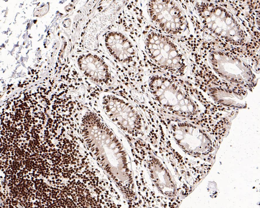 Immunohistochemistry: RbBP5 Antibody (PSH0-16) [NBP3-32896] - Immunohistochemical analysis of paraffin-embedded human colon tissue with Rabbit anti-RbBP5 antibody (NBP3-32896) at 1/200 dilution. The section was pre-treated using heat mediated antigen retrieval with sodium citrate buffer (pH 6.0) for 2 minutes. The tissues were blocked in 1% BSA for 20 minutes at room temperature, washed with ddH2O and PBS, and then probed with the primary antibody (NBP3-32896) at 1/200 dilution for 1 hour at room temperature. The detection was performed using an HRP conjugated compact polymer system. DAB was used as the chromogen. Tissues were counterstained with hematoxylin and mounted with DPX.