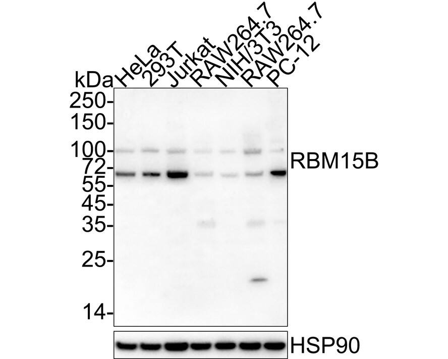 Western blot analysis on different lysates with NBP3-32898 at 1/2,000 dilution. Lane 1: HeLa cell lysate Lane 2: 293T cell lysate Lane 3: Jurkat cell lysate Lane 4: RAW264.7 cell lysate Lane 5: NIH/3T3 cell lysate Lane 6: RAW264.7 cell lysate Lane 7: PC-12 cell lysate Lysates/proteins at 30 µg/Lane. Predicted band size: 97 kDa Observed band size: 100 kDa The expression profile/ molecular weight observed is consistent with what has been described in the literature (PMID: 27602518). The bands below 100 kDa may be caused by degradation. Exposure time: 1 minute 21 seconds; 4-20% SDS-PAGE gel. Proteins were transferred to a PVDF membrane and blocked with 5% NFDM/TBST for 1 hour at room temperature. NBP3-32898 at 1/2,000 dilution was used in 5% NFDM/TBST at 4℃ overnight. Goat anti-Mouse IgG [HRP] at 1/50,000 dilution was used for 1 hour at room temperature.