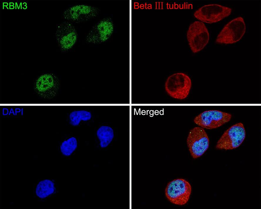 Immunocytochemistry/ Immunofluorescence: RBM3 Antibody (JE63-84) [NBP3-32899] - Immunocytochemistry analysis of Hela cells labeling RBM3 with Rabbit anti-RBM3 antibody (NBP3-32899) at 1/50 dilution. Cells were fixed in 4% paraformaldehyde for 10 minutes at 37 ℃, permeabilized with 0.05% Triton X-100 in PBS for 20 minutes, and then blocked with 2% negative goat serum for 30 minutes at room temperature. Cells were then incubated with Rabbit anti-RBM3 antibody (NBP3-32899) at 1/50 dilution in 2% negative goat serum overnight at 4 ℃. Goat Anti-Rabbit IgG H&L (Alexa Fluor® 488) was used as the secondary antibody at 1/1,000 dilution. Nuclear DNA was labelled in blue with DAPI. Beta III tubulin (M0805-8, red) was stained at 1/200 dilution overnight at +4℃. Goat Anti-Mouse IgG H&L (Alexa Fluor® 647) were used as the secondary antibody at 1/1,000 dilution.