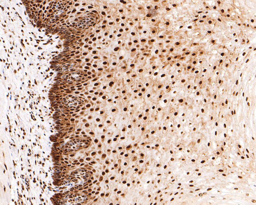 Immunohistochemistry: RBM3 Antibody (JE63-84) [NBP3-32899] - Immunohistochemical analysis of paraffin-embedded human esophagus tissue with Rabbit anti-RBM3 antibody (NBP3-32899) at 1/400 dilution. The section was pre-treated using heat mediated antigen retrieval with sodium citrate buffer (pH 6.0) for 2 minutes. The tissues were blocked in 1% BSA for 20 minutes at room temperature, washed with ddH2O and PBS, and then probed with the primary antibody (NBP3-32899) at 1/400 dilution for 1 hour at room temperature. The detection was performed using an HRP conjugated compact polymer system. DAB was used as the chromogen. Tissues were counterstained with hematoxylin and mounted with DPX.