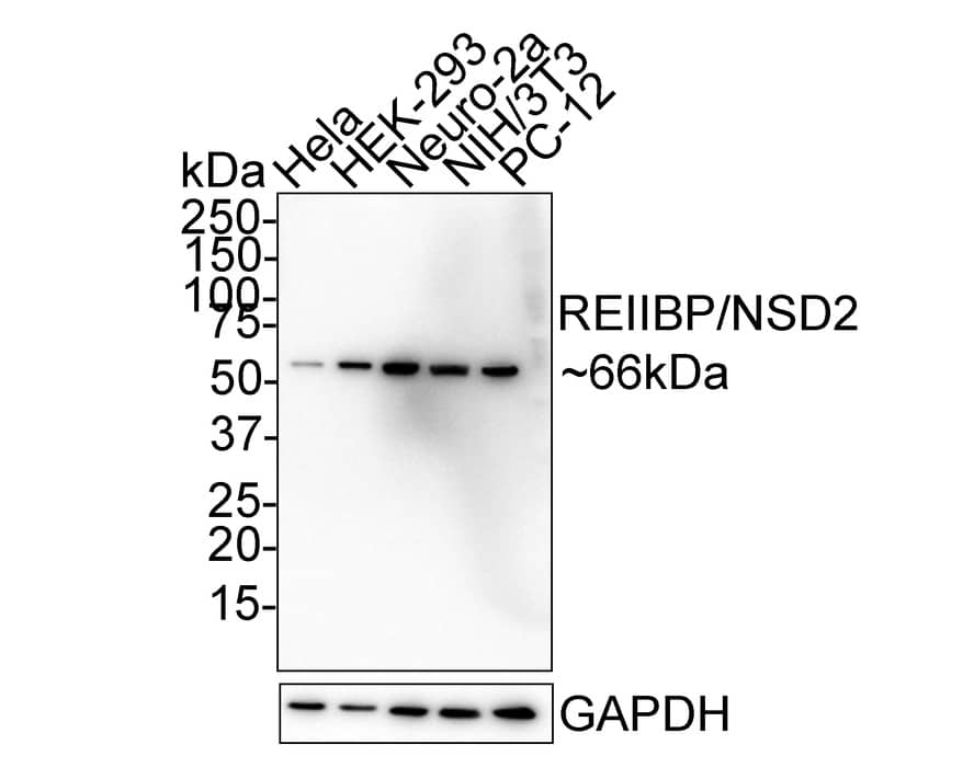 Western blot analysis on different lysates with NBP3-32901 at 1/1,000 dilution. Lane 1: HeLa cell lysate Lane 2: HEK-293 cell lysate Lane 3: Neuro-2a cell lysate Lane 4: NIH/3T3 cell lysate Lane 5: PC-12 cell lysate Lysates/proteins at 20 µg/Lane. Predicted band size: 66 kDa Observed band size: 66 kDa Exposure time: 1 minute; 4-20% SDS-PAGE gel. Proteins were transferred to a PVDF membrane and blocked with 5% NFDM/TBST for 1 hour at room temperature. NBP3-32901 at 1/1,000 dilution was used in 5% NFDM/TBST at room temperature for 2 hours. Goat Anti-Rabbit IgG [HRP] Secondary Antibody at 1/50,000 dilution was used for 1 hour at room temperature.