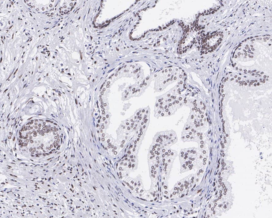 Immunohistochemistry: RING1 Antibody (JE34-66) [NBP3-32904] - Immunohistochemical analysis of paraffin-embedded human prostate tissue with Rabbit anti-RING1 antibody (NBP3-32904) at 1/200 dilution. The section was pre-treated using heat mediated antigen retrieval with sodium citrate buffer (pH 6.0) for 2 minutes. The tissues were blocked in 1% BSA for 20 minutes at room temperature, washed with ddH2O and PBS, and then probed with the primary antibody (NBP3-32904) at 1/200 dilution for 1 hour at room temperature. The detection was performed using an HRP conjugated compact polymer system. DAB was used as the chromogen. Tissues were counterstained with hematoxylin and mounted with DPX.