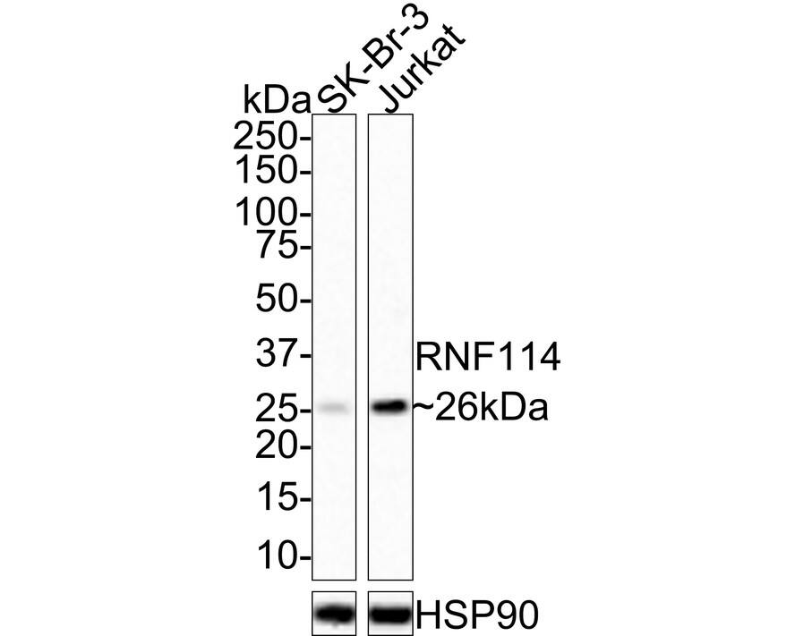 Western Blot: RNF114 Antibody (PSH01-99) [NBP3-32910] - Western blot analysis of RNF114 on different lysates with Rabbit anti-RNF114 antibody (NBP3-32910) at 1/1,000 dilution. Lane 1: SK-Br-3 cell lysate Lane 2: Jurkat cell lysate Lysates/proteins at 40 ug/Lane. Predicted band size: 26 kDa Observed band size: 26 kDa Exposure time: 1 minute 40 seconds; 4-20% SDS-PAGE gel. Proteins were transferred to a PVDF membrane and blocked with 5% NFDM/TBST for 1 hour at room temperature. The primary antibody (NBP3-32910) at 1/1,000 dilution was used in 5% NFDM/TBST at room temperature for 2 hours. Goat Anti-Rabbit IgG - HRP Secondary Antibody at 1:100,000 dilution was used for 1 hour at room temperature.