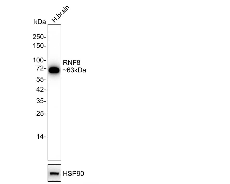 Western Blot: RNF8 Antibody (JE56-43) [NBP3-32912] - Western blot analysis of RNF8 on human brain tissue lysates with Rabbit anti-RNF8 antibody (NBP3-32912) at 1/2,000 dilution. Lysates/proteins at 40 ug/Lane. Predicted band size: 56 kDa Observed band size: 63 kDa Exposure time: 3 minutes; 4-20% SDS-PAGE gel. Proteins were transferred to a PVDF membrane and blocked with 5% NFDM/TBST for 1 hour at room temperature. The primary antibody (NBP3-32912) at 1/2,000 dilution was used in 5% NFDM/TBST at 4C overnight. Goat Anti-Rabbit IgG - HRP Secondary Antibody at 1/50,000 dilution was used for 1 hour at room temperature.