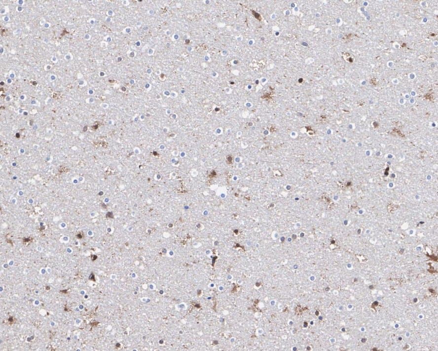 Immunohistochemistry: RNF8 Antibody (JE56-43) [NBP3-32912] - Immunohistochemical analysis of paraffin-embedded human brain tissue with Rabbit anti-RNF8 antibody (NBP3-32912) at 1/500 dilution. The section was pre-treated using heat mediated antigen retrieval with sodium citrate buffer (pH 6.0) for 2 minutes. The tissues were blocked in 1% BSA for 20 minutes at room temperature, washed with ddH2O and PBS, and then probed with the primary antibody (NBP3-32912) at 1/500 dilution for 1 hour at room temperature. The detection was performed using an HRP conjugated compact polymer system. DAB was used as the chromogen. Tissues were counterstained with hematoxylin and mounted with DPX.