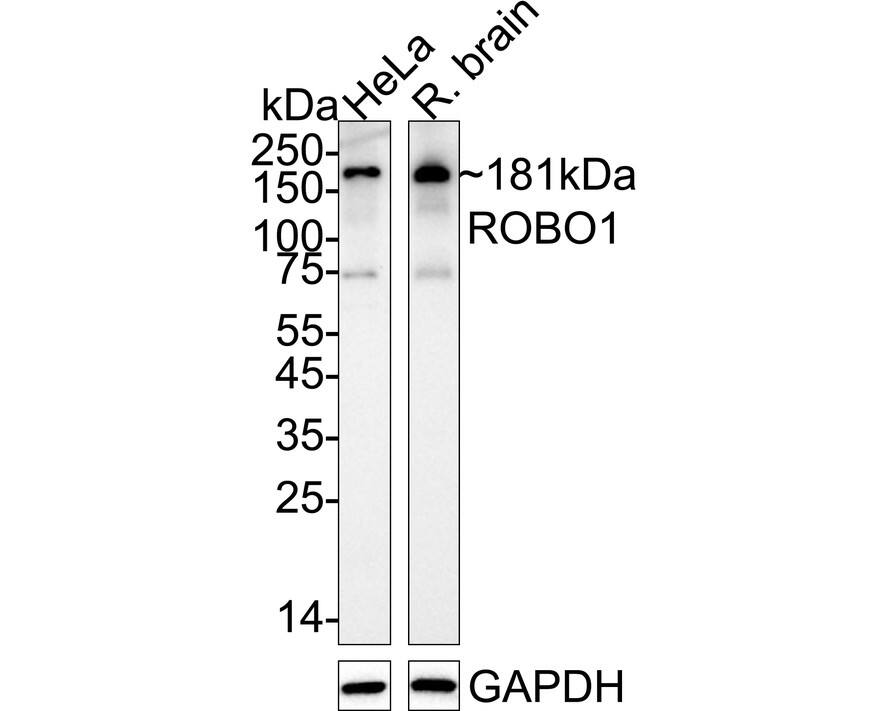 Western blot analysis on different lysates with NBP3-32913 at 1/1,000 dilution. Lane 1: HeLa cell lysate (15 µg/Lane) Lane 2: Rat brain tissue lysate (40 µg/Lane) Predicted band size: 181 kDa Observed band size: 181 kDa Exposure time: 3 minutes;  4-20% SDS-PAGE gel. Proteins were transferred to a PVDF membrane and blocked with 5% NFDM/TBST for 1 hour at room temperature. NBP3-32913 at 1/1,000 dilution was used in primary antibody dilution at 4℃ overnight. Goat anti-Mouse IgG [HRP] at 1/50,000 dilution was used for 1 hour at room temperature.