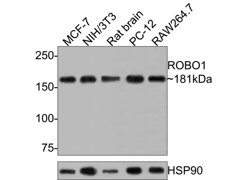 Western Blot: ROBO1 Antibody (10E2-R) [NBP3-32913] - Western blot analysis of ROBO1 on different lysates with Mouse anti-ROBO1 antibody (NBP3-32913) at 1/1,000 dilution. Lane 1: MCF-7 cell lysate (10 ug/Lane) Lane 2: NIH/3T3 cell lysate (10 ug/Lane) Lane 3: Rat brain tissue lysate (20 ug/Lane) Lane 4: PC-12 cell lysate (10 ug/Lane) Lane 5: RAW264.7 cell lysate (10 ug/Lane) Predicted band size: 181 kDa Observed band size: 181 kDa Exposure time: 30 seconds; 6% SDS-PAGE gel. Proteins were transferred to a PVDF membrane and blocked with 5% NFDM/TBST for 1 hour at room temperature. The primary antibody (NBP3-32913) at 1/1,000 dilution was used in 5% NFDM/TBST at room temperature for 2 hours. Goat Anti-Mouse IgG - HRP Secondary Antibody at 1:300,000 dilution was used for 1 hour at room temperature.